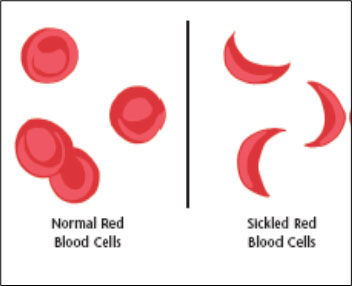 am-sickle-3